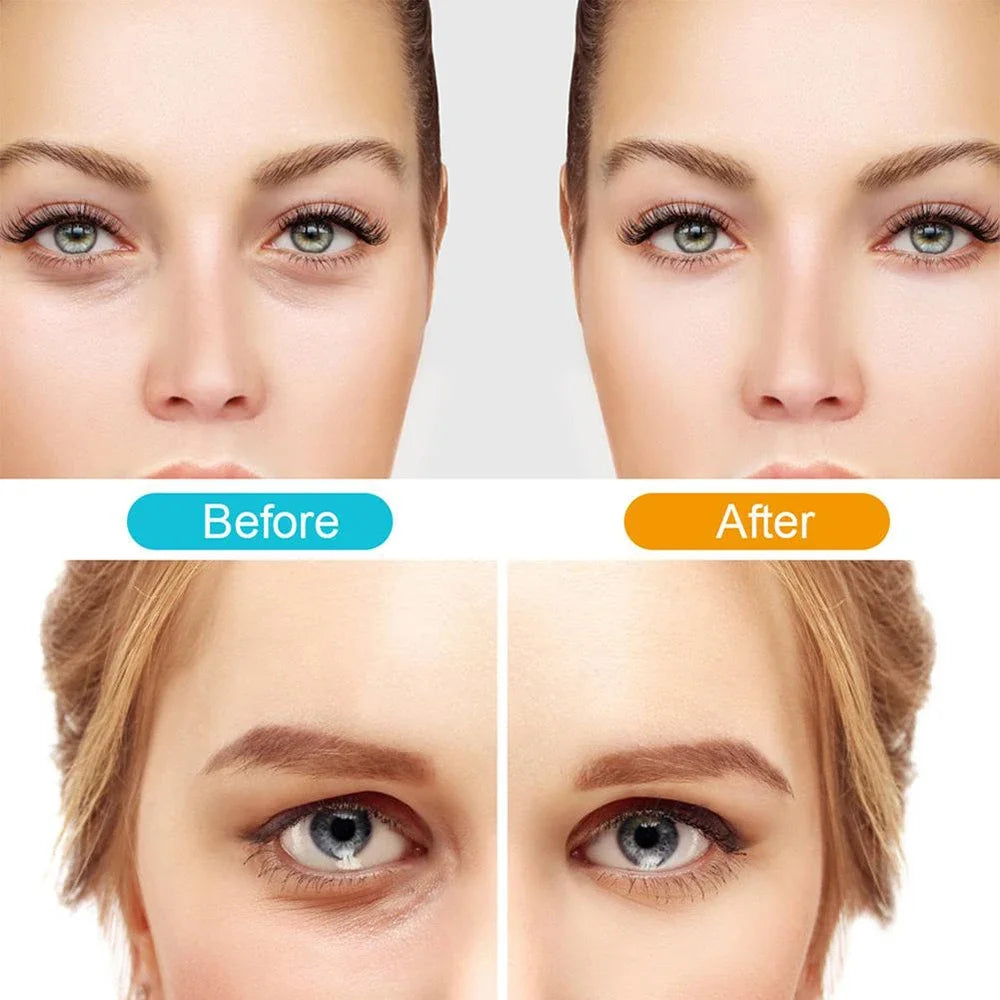 3D Red Light EMS Eye Massager Eyecare Glasses Dark Circles Puffiness Wrinkles Reduction Eye Fatigue Relaxing Beauty Care Device